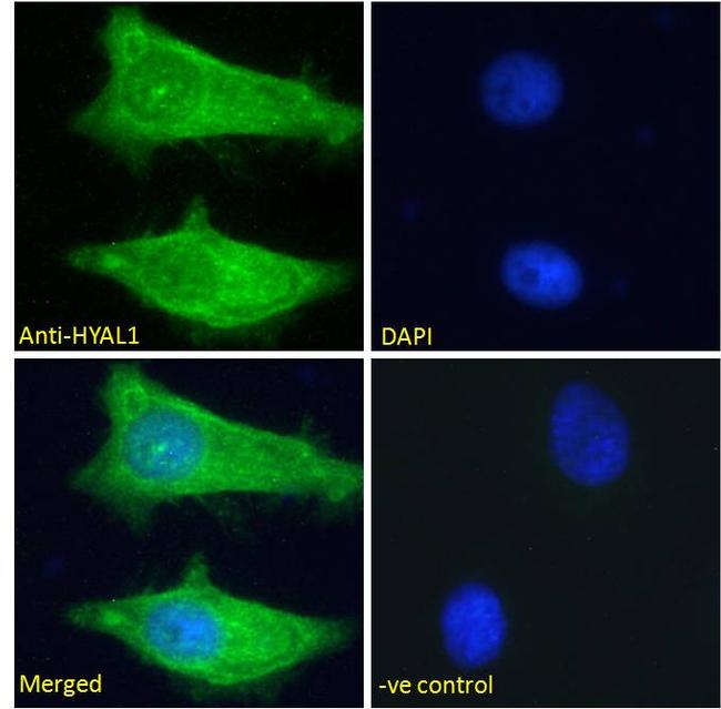 HYAL1 Antibody in Immunocytochemistry (ICC/IF)