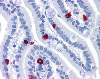 GCC2 Antibody in Immunohistochemistry (Paraffin) (IHC (P))