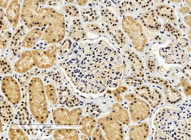 ENOX2 Antibody in Immunohistochemistry (Paraffin) (IHC (P))