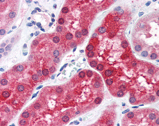 ABHD4 Antibody in Immunohistochemistry (Paraffin) (IHC (P))