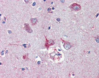 Nodal Antibody in Immunohistochemistry (Paraffin) (IHC (P))