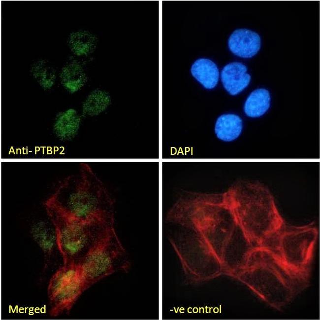 PTBP2 Antibody in Immunocytochemistry (ICC/IF)