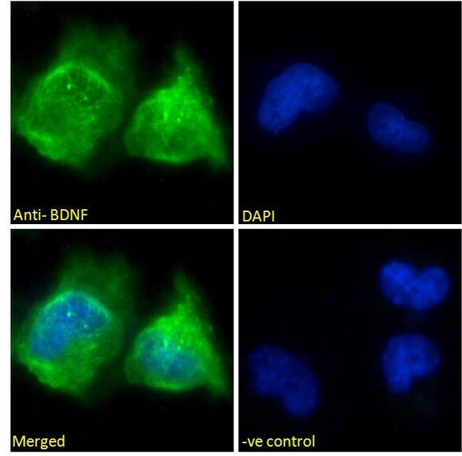 BDNF Antibody in Immunocytochemistry (ICC/IF)