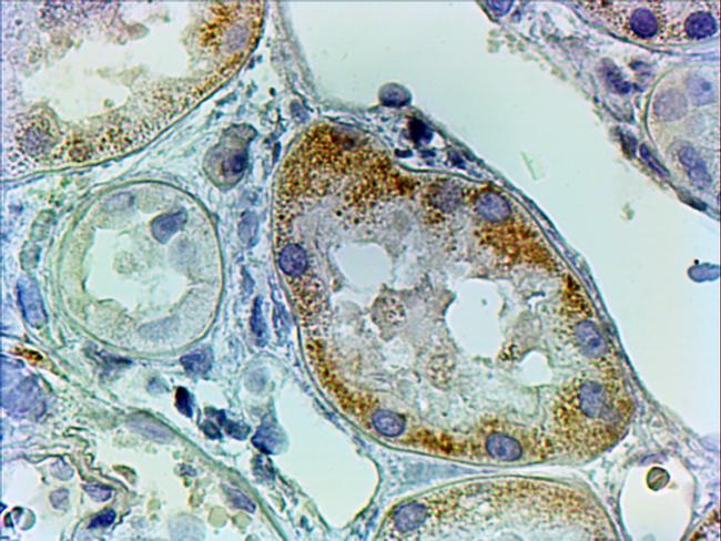 AADAT Antibody in Immunohistochemistry (Paraffin) (IHC (P))