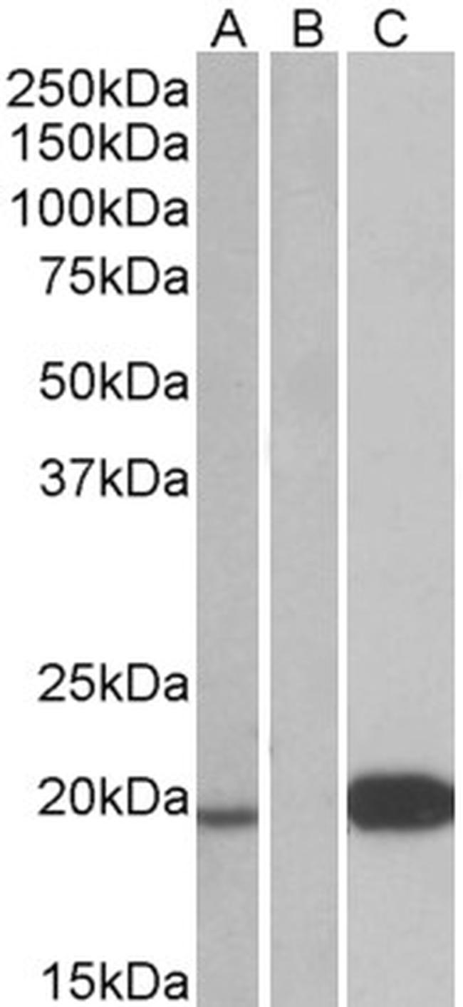 UCN3 Antibody in Western Blot (WB)