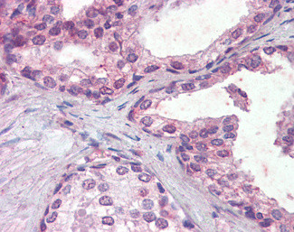 IFNAR2 Antibody in Immunohistochemistry (Paraffin) (IHC (P))