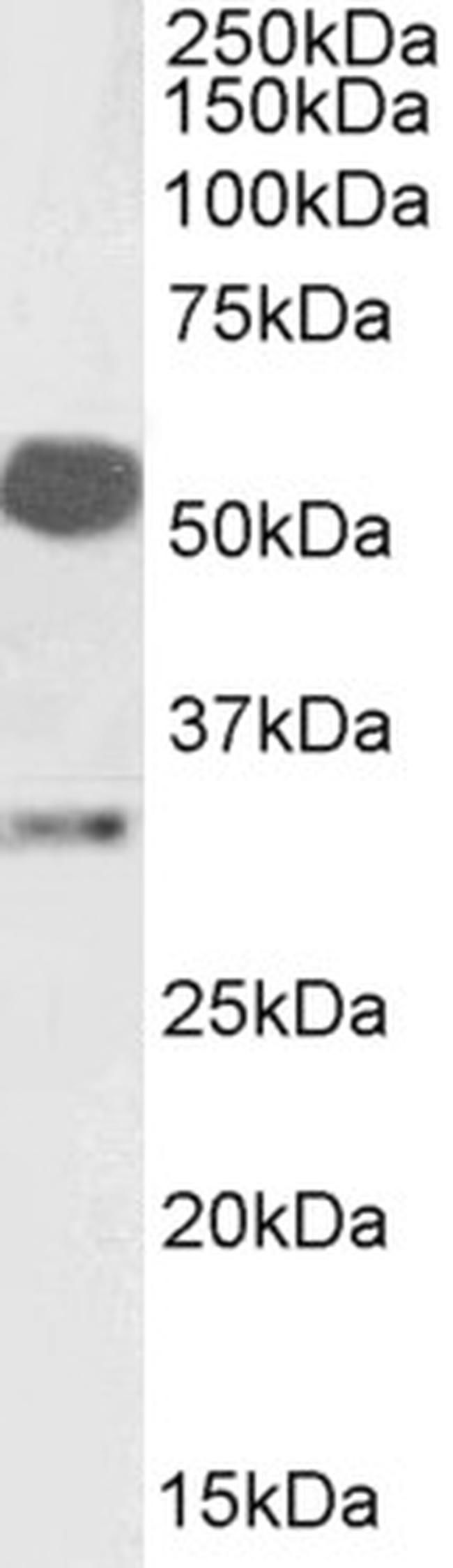 Estrogen Receptor beta Antibody in Western Blot (WB)