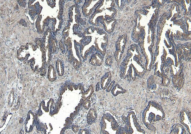 CEP290 Antibody in Immunohistochemistry (Paraffin) (IHC (P))