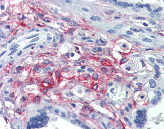 SLC46A1 Antibody in Immunohistochemistry (Paraffin) (IHC (P))