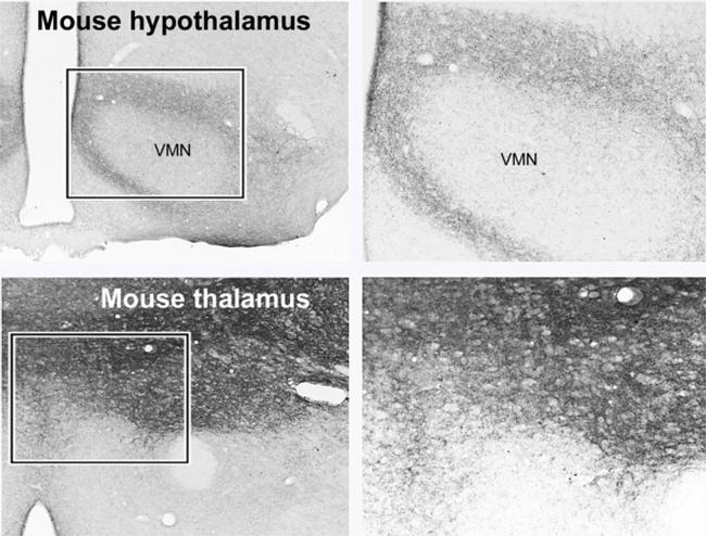 VGLUT1 Antibody in Immunohistochemistry (Paraffin) (IHC (P))