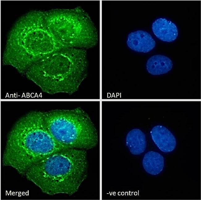 ABCA4 Antibody in Immunocytochemistry (ICC/IF)