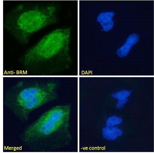 SMARCA2 Antibody in Immunocytochemistry (ICC/IF)