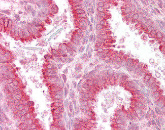 USP28 Antibody in Immunohistochemistry (Paraffin) (IHC (P))