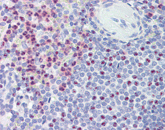 Polycystin 1 Antibody in Immunohistochemistry (Paraffin) (IHC (P))