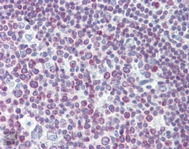 PAX7 Antibody in Immunohistochemistry (Paraffin) (IHC (P))