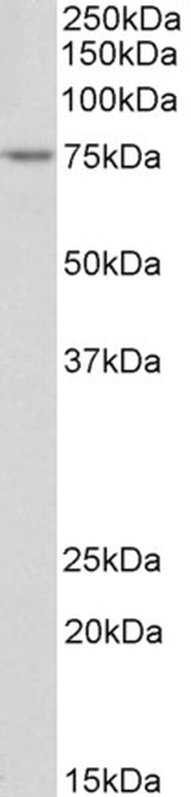 TDP1 Antibody in Western Blot (WB)