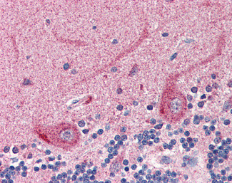 SLC22A17 Antibody in Immunohistochemistry (Paraffin) (IHC (P))