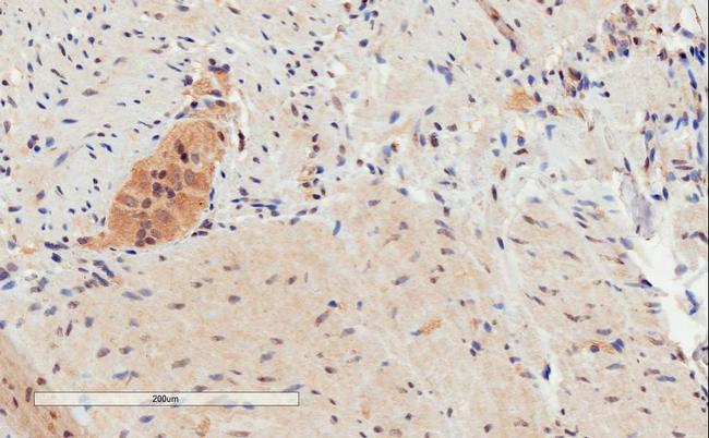 GPR120 Antibody in Immunohistochemistry (Paraffin) (IHC (P))