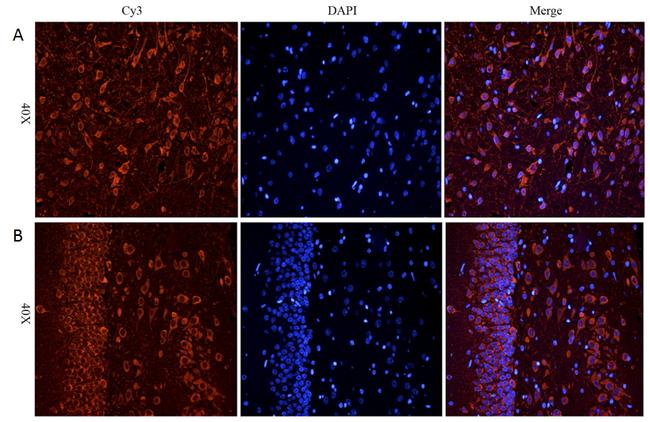 CHRNA7 Antibody in Immunohistochemistry (Paraffin) (IHC (P))