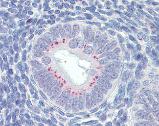 SFRP1 Antibody in Immunohistochemistry (Paraffin) (IHC (P))