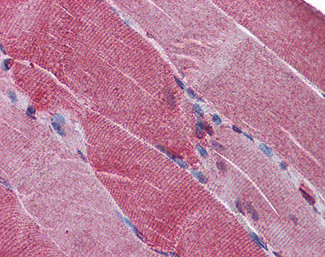 PCSK6 Antibody in Immunohistochemistry (Paraffin) (IHC (P))