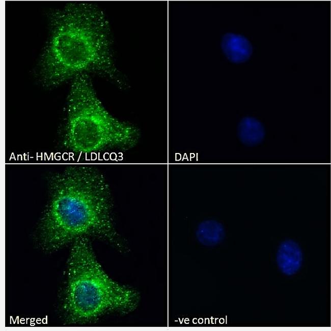 HMGCR Antibody in Immunocytochemistry (ICC/IF)