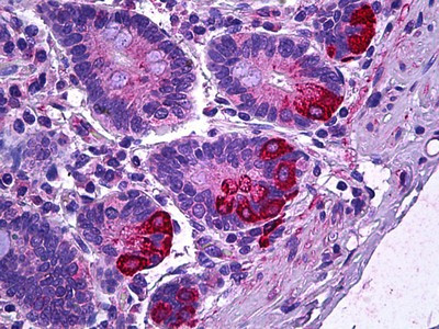 IL-12 p35 Antibody in Immunohistochemistry (Paraffin) (IHC (P))