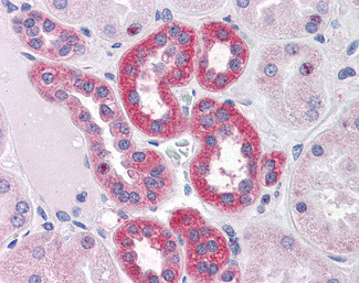 PARP3 Antibody in Immunohistochemistry (Paraffin) (IHC (P))