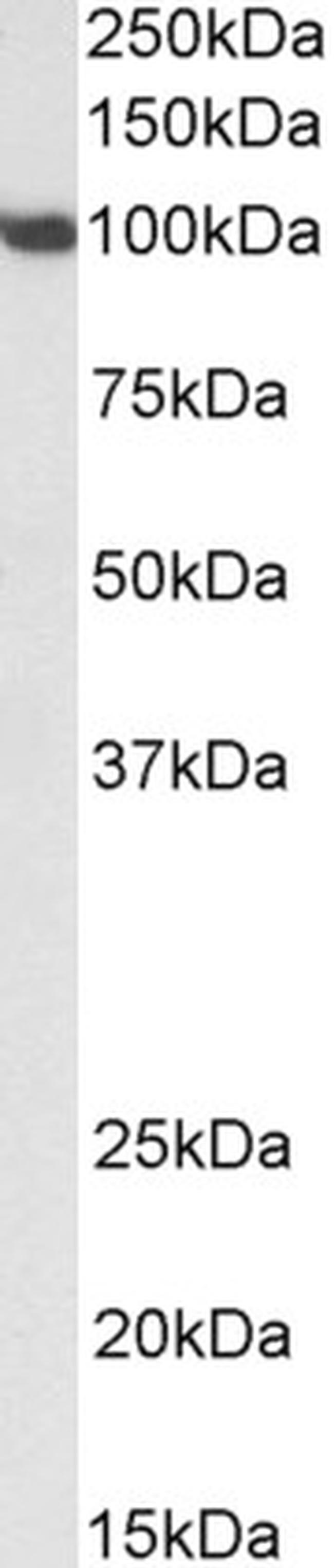 SP1 Antibody in Western Blot (WB)