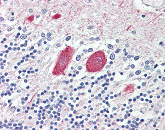 MTNR1B Antibody in Immunohistochemistry (Paraffin) (IHC (P))