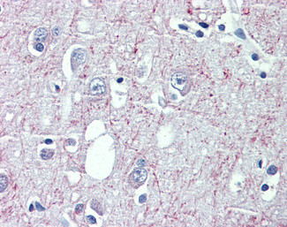 GABBR1 Antibody in Immunohistochemistry (Paraffin) (IHC (P))