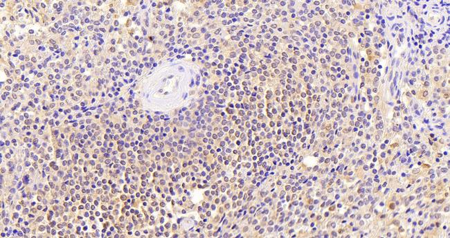 Thrombospondin 1 Antibody in Immunohistochemistry (Paraffin) (IHC (P))