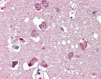 Nogo-A Antibody in Immunohistochemistry (Paraffin) (IHC (P))