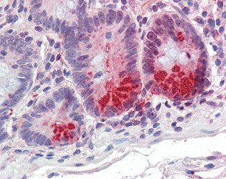 SRD5A1 Antibody in Immunohistochemistry (Paraffin) (IHC (P))