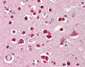 GRIK5 Antibody in Immunohistochemistry (Paraffin) (IHC (P))