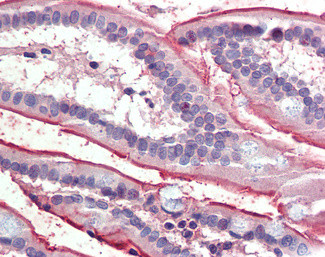 SGLT1 Antibody in Immunohistochemistry (Paraffin) (IHC (P))