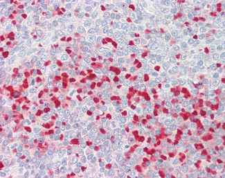 MTHFR Antibody in Immunohistochemistry (Paraffin) (IHC (P))