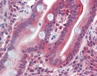 GLUT5 Antibody in Immunohistochemistry (Paraffin) (IHC (P))