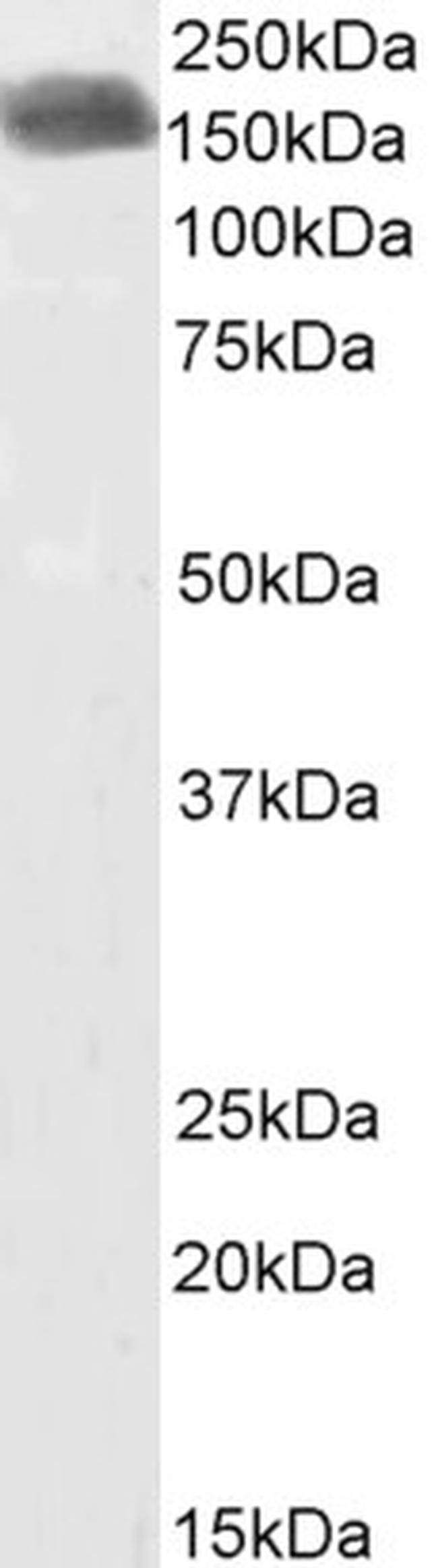 CLIP1 Antibody in Western Blot (WB)