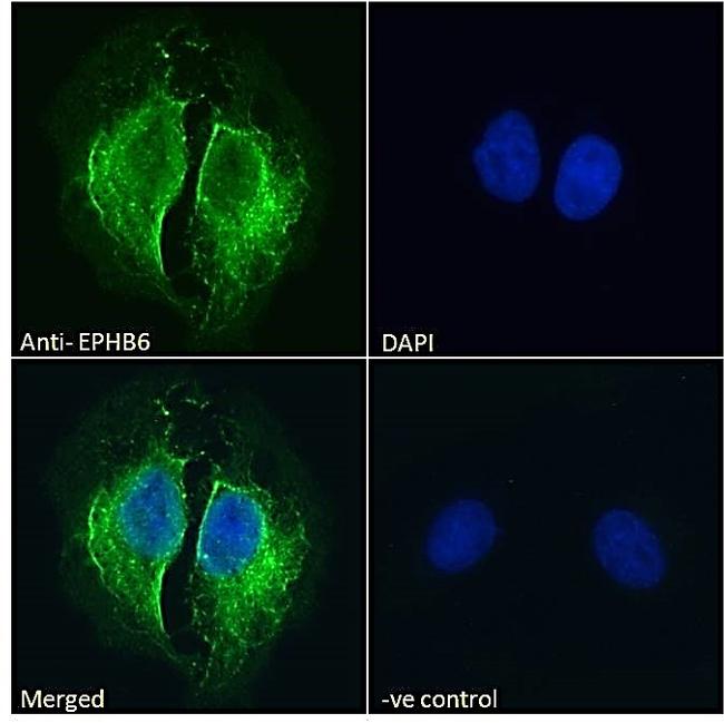 EphB6 Antibody in Immunocytochemistry (ICC/IF)