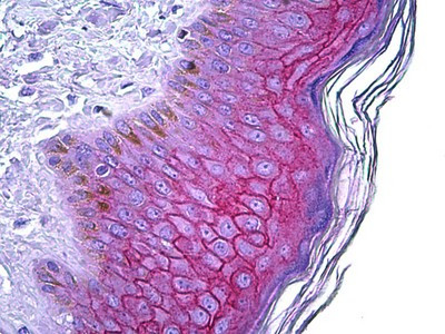 Desmoglein 1 Antibody in Immunohistochemistry (Paraffin) (IHC (P))