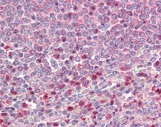 UBR4 Antibody in Immunohistochemistry (Paraffin) (IHC (P))