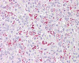 PFKFB2 Antibody in Immunohistochemistry (Paraffin) (IHC (P))