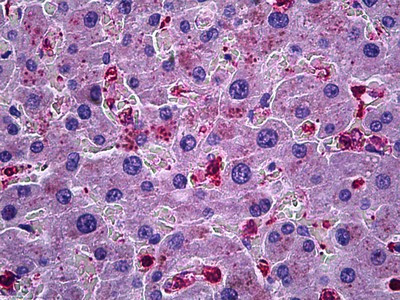 CCL20 Antibody in Immunohistochemistry (Paraffin) (IHC (P))