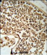 SERPINH1 Antibody in Immunohistochemistry (Paraffin) (IHC (P))