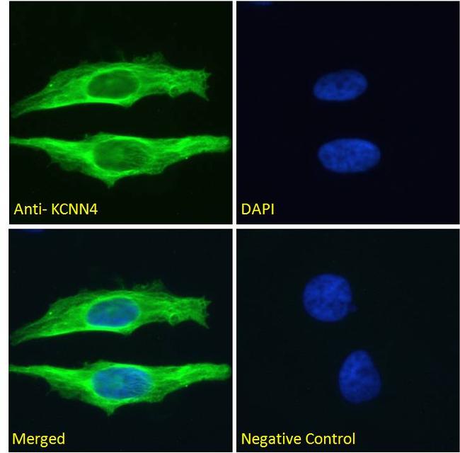 KCNN4 Antibody in Immunocytochemistry (ICC/IF)