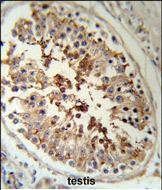 SERPINH1 Antibody in Immunohistochemistry (Paraffin) (IHC (P))