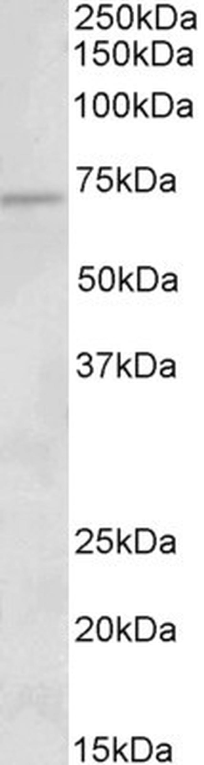 ACADVL Antibody in Western Blot (WB)