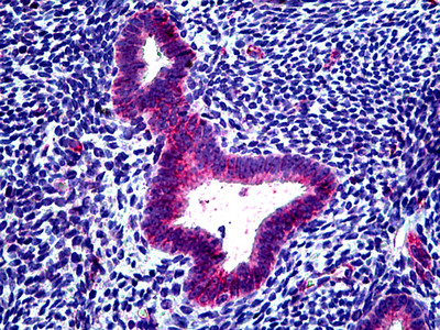 CLCN2 Antibody in Immunohistochemistry (Paraffin) (IHC (P))