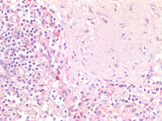 Oct-2 Antibody in Immunohistochemistry (Paraffin) (IHC (P))